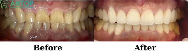 z6677289765843 28006b11f540b34bf9cae574ca314f13